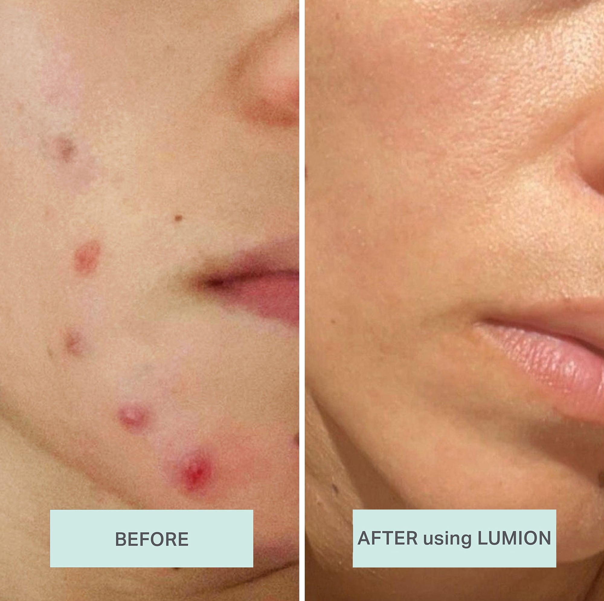 Lumion Miracle Mist
