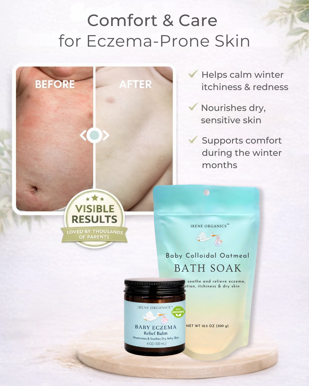 Irene Organics Baby Eczema Relief Bundle