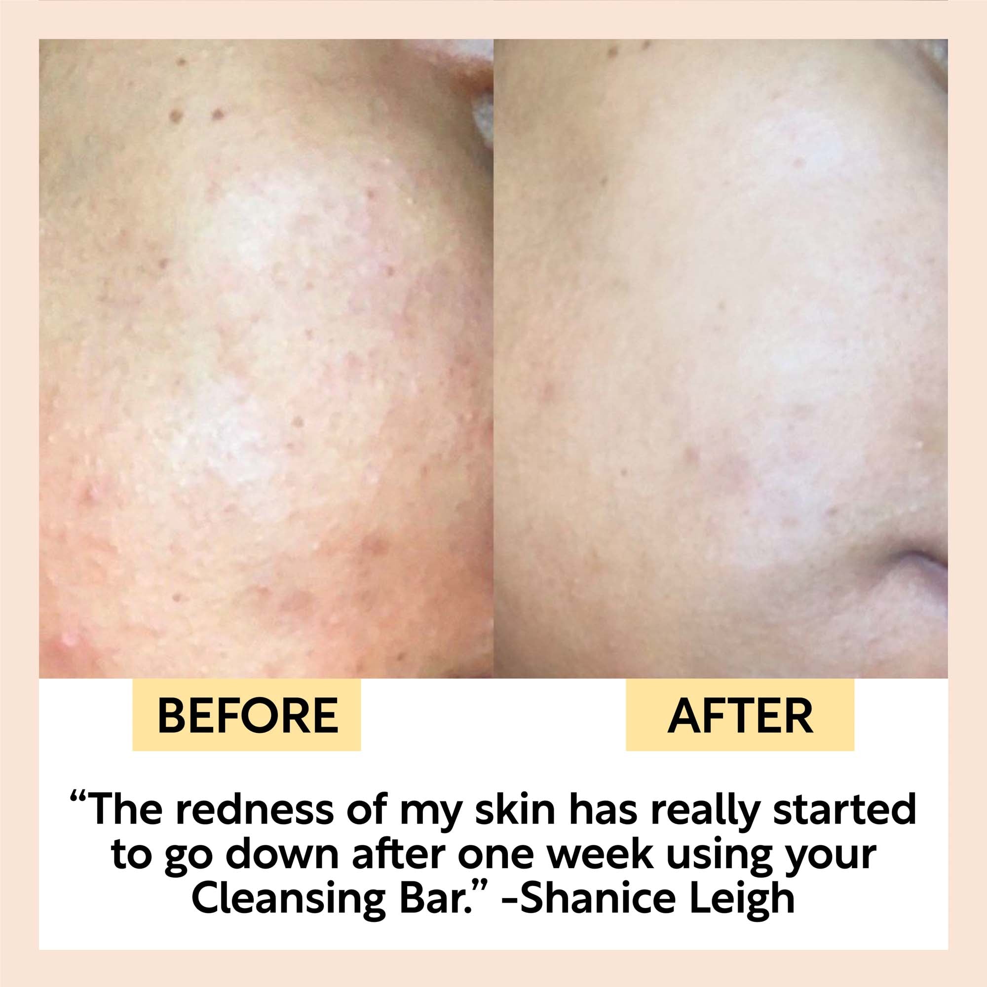 UpCircle Chai Soap Cleansing Duo