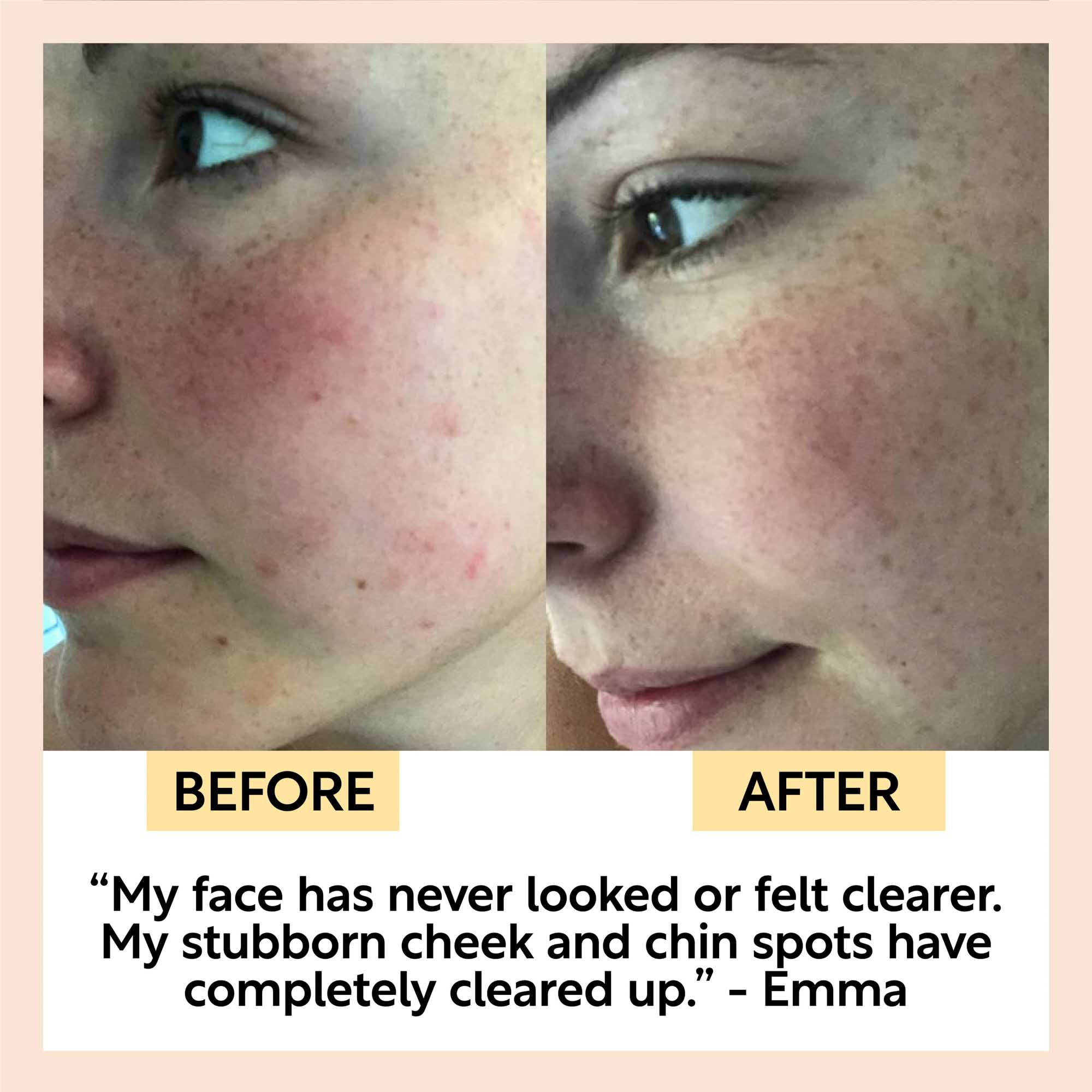 UpCircle Chai Soap Cleansing Duo