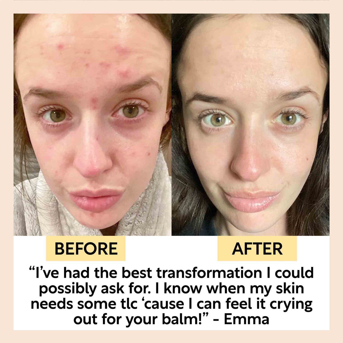 UpCircle Cleansing Face Balm with Oat Oil + Vitamin E