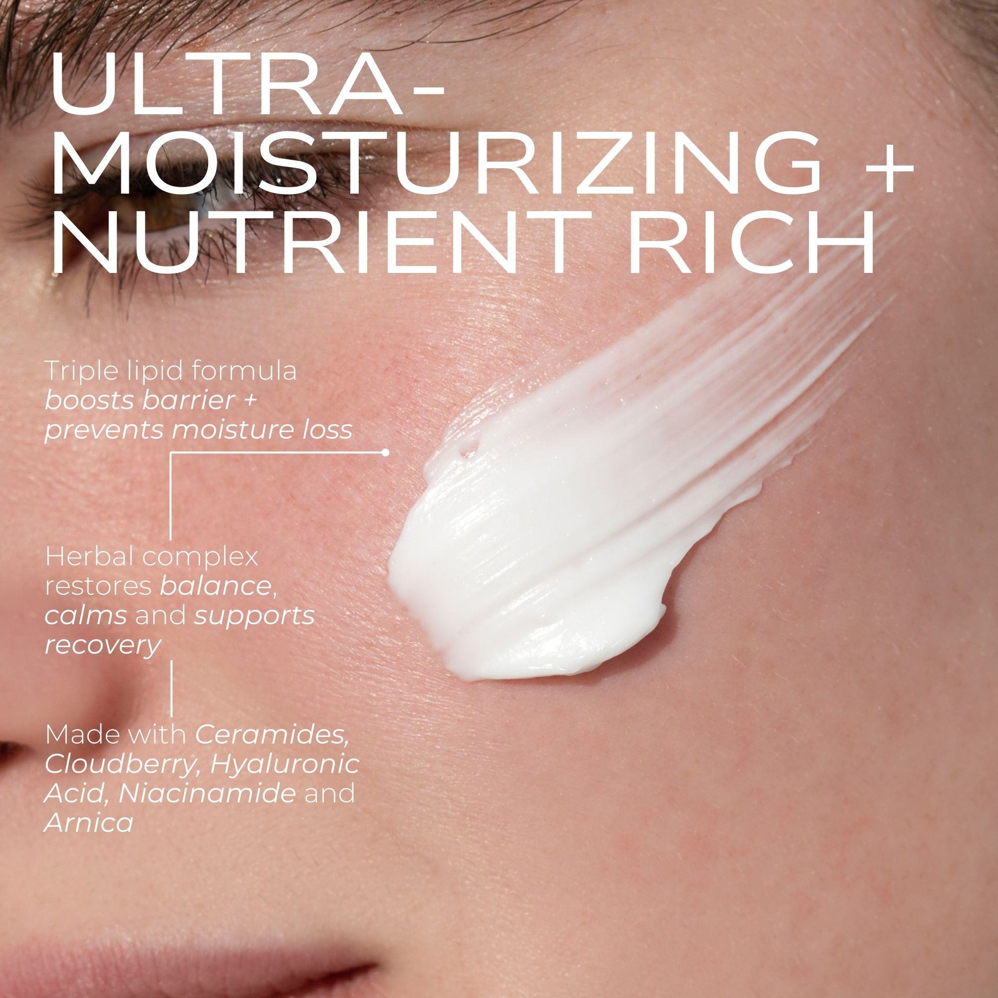Fitglow Beauty Cloud Ceramide + HA Recovery Balm