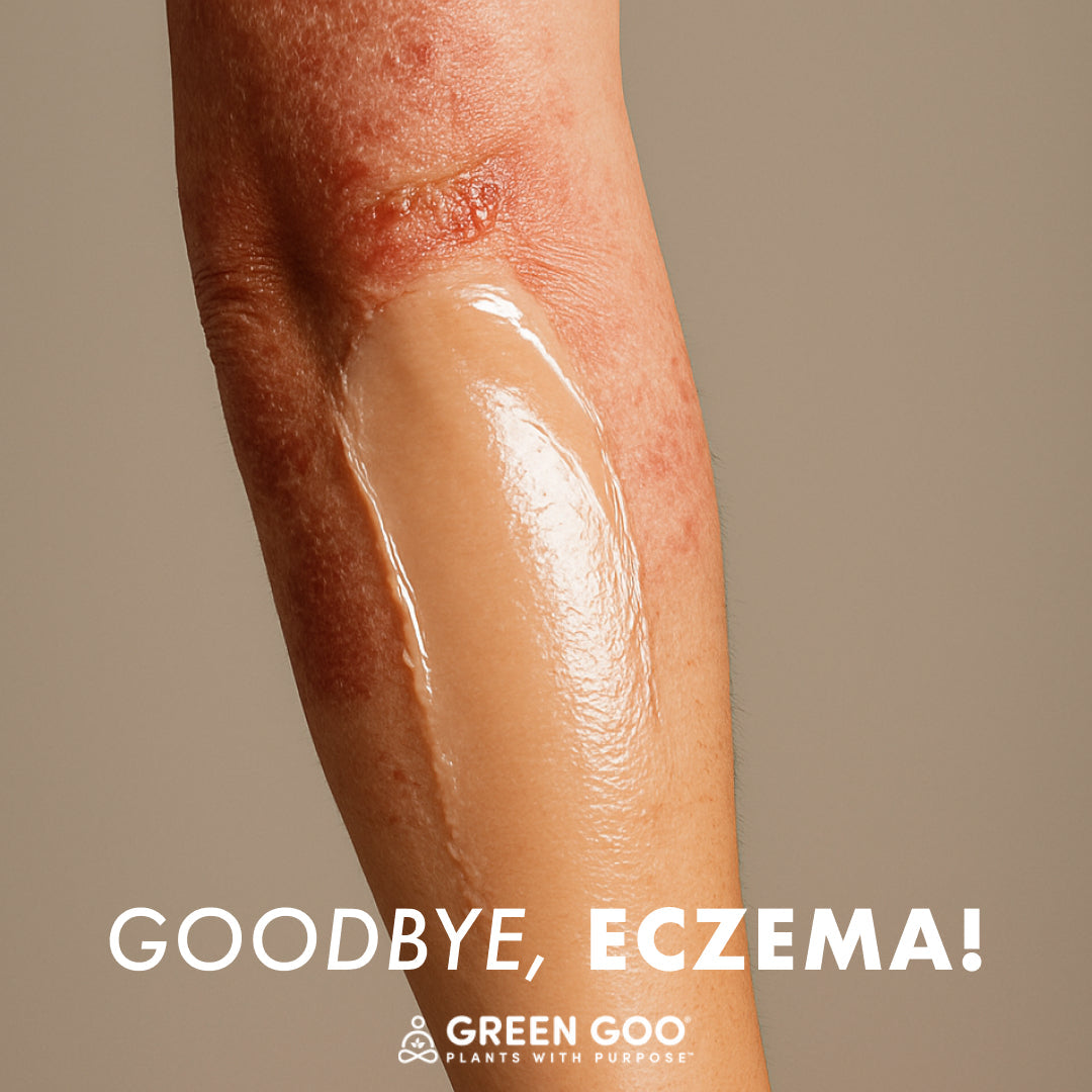 Green Goo Dry Skin