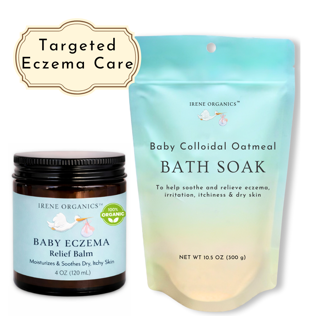 Irene Organics Baby Eczema Relief Bundle