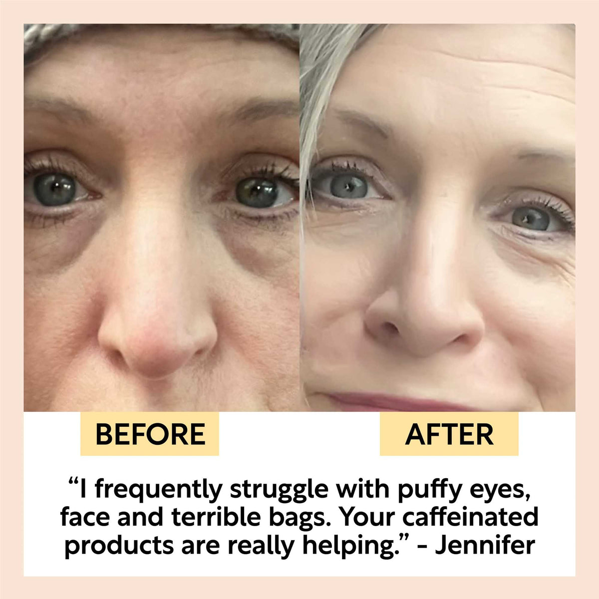 UpCircle Day + Night Eye Care Bundle