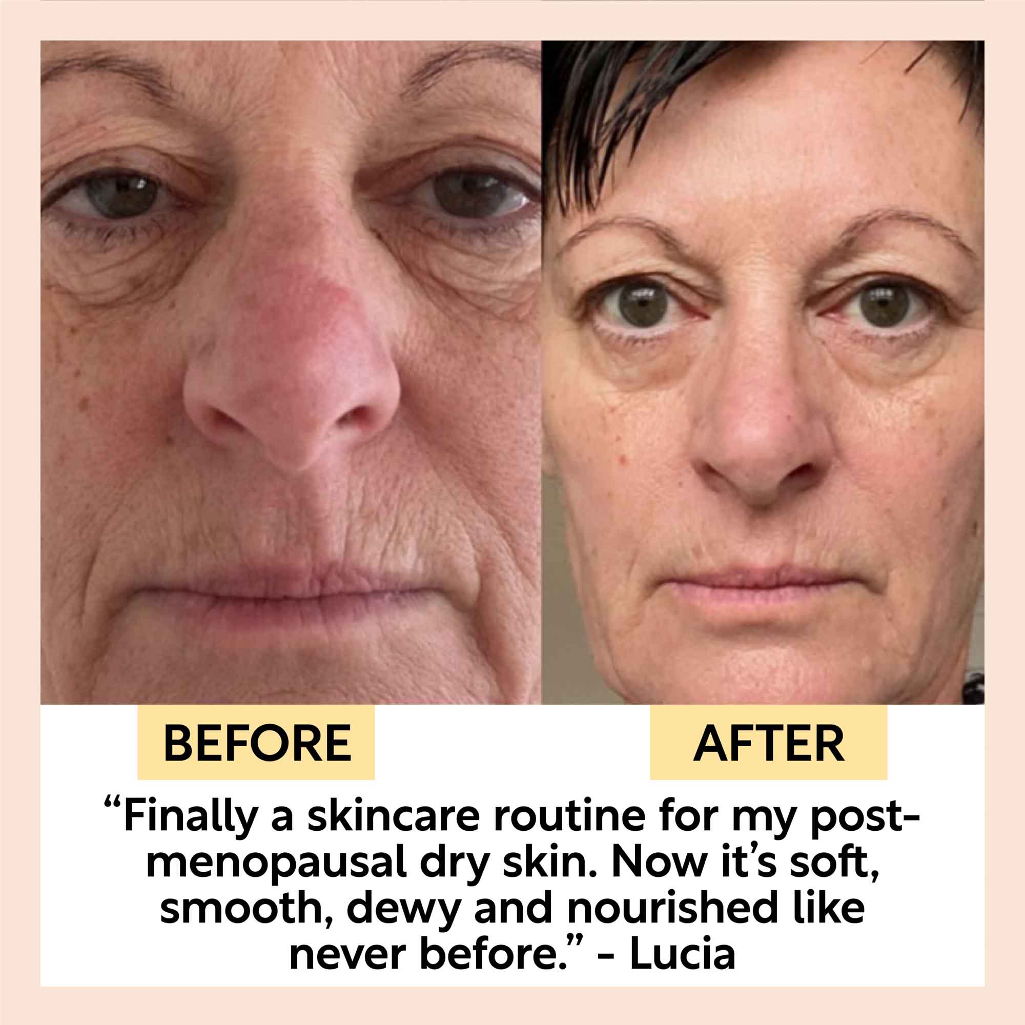 UpCircle Anti-Aging Skincare Bundle