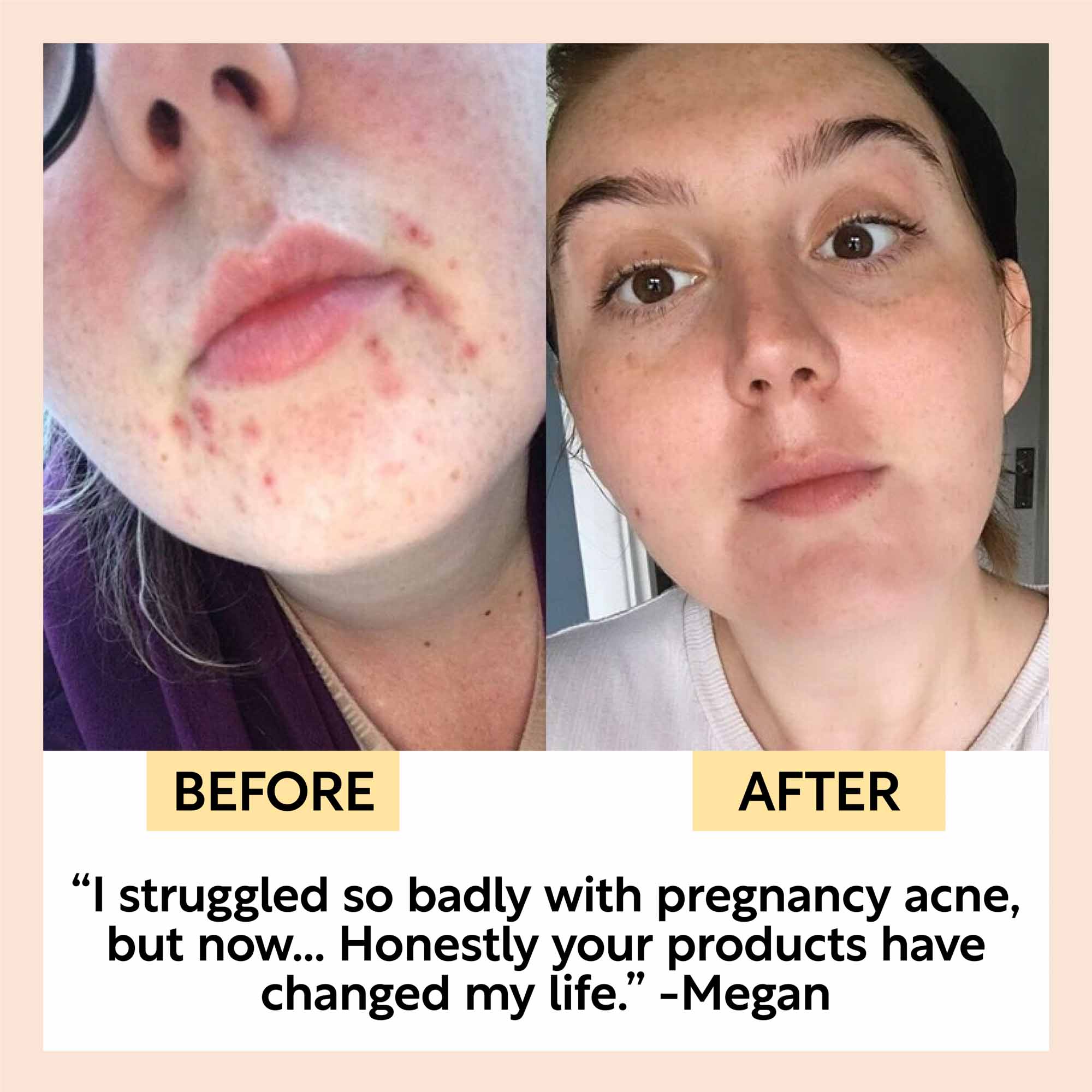 UpCircle Cleanse, Tone + Moisturize Set