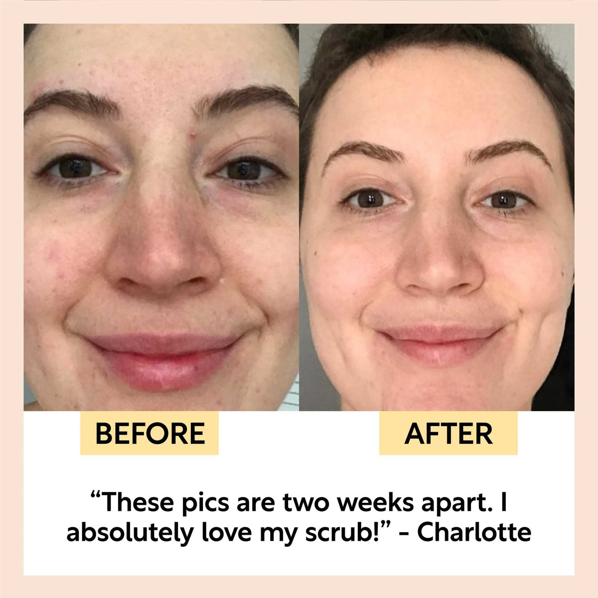UpCircle Natural Face Scrub – Citrus Blend for Dry Skin