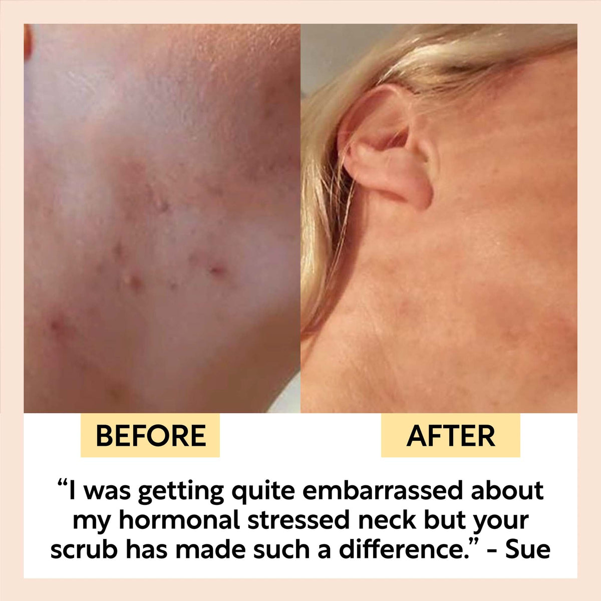 UpCircle Natural Face Scrub – Citrus Blend for Dry Skin