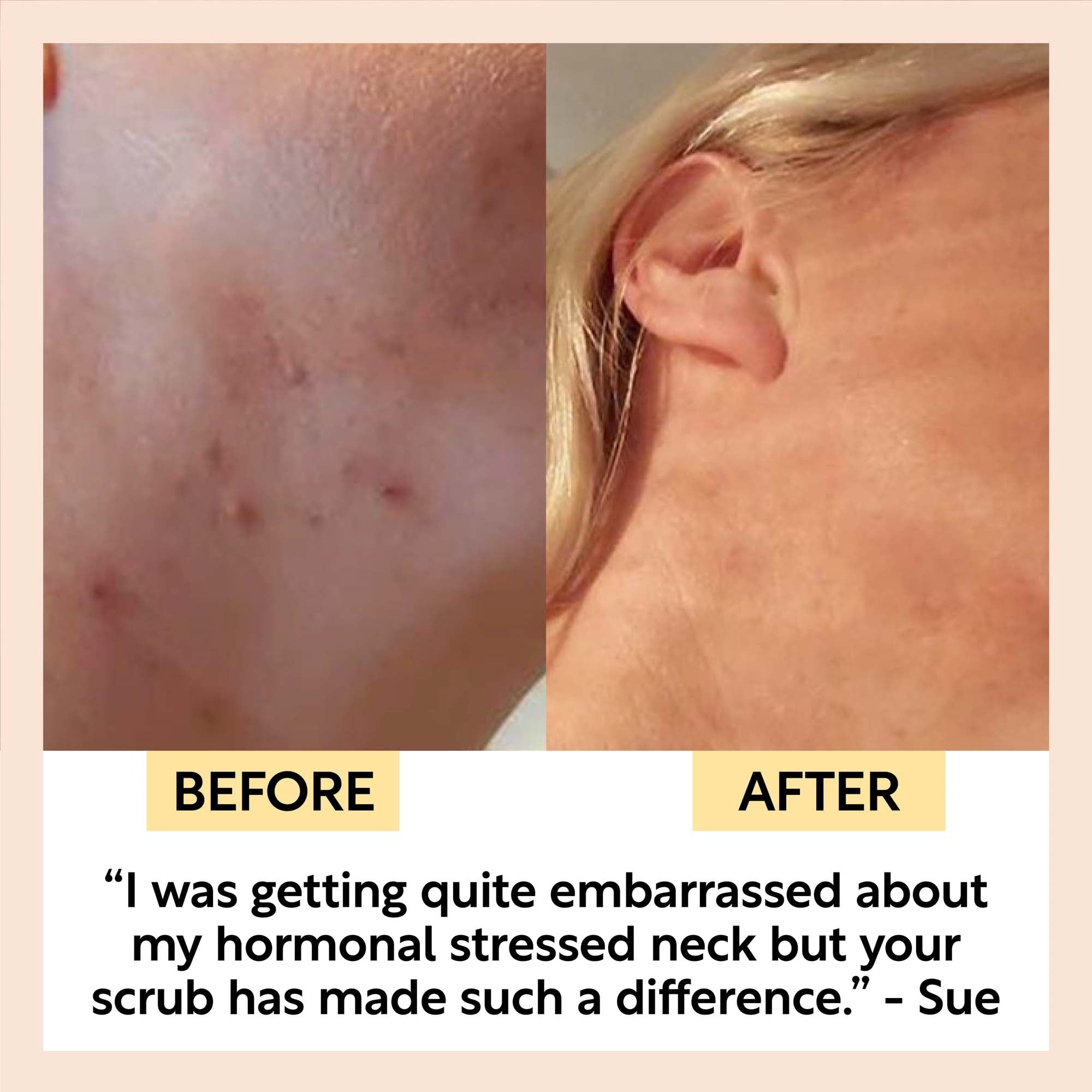 UpCircle Natural Face Scrub – Citrus Blend – Travel Size