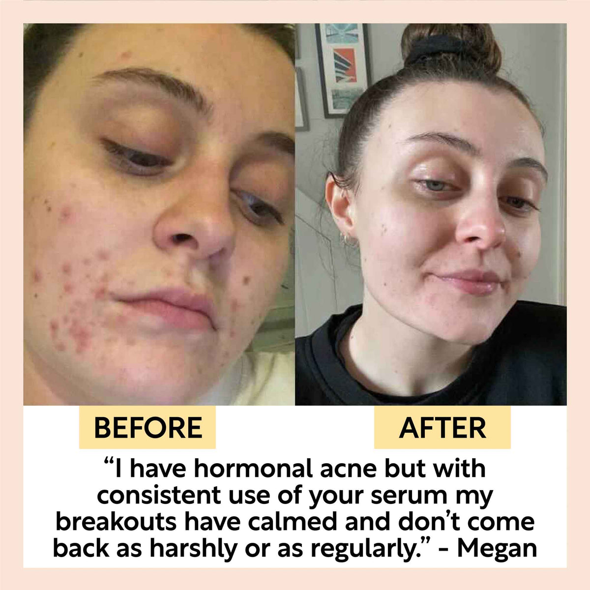 UpCircle Hydrating Face Oil with Coffee Oil - Jumbo