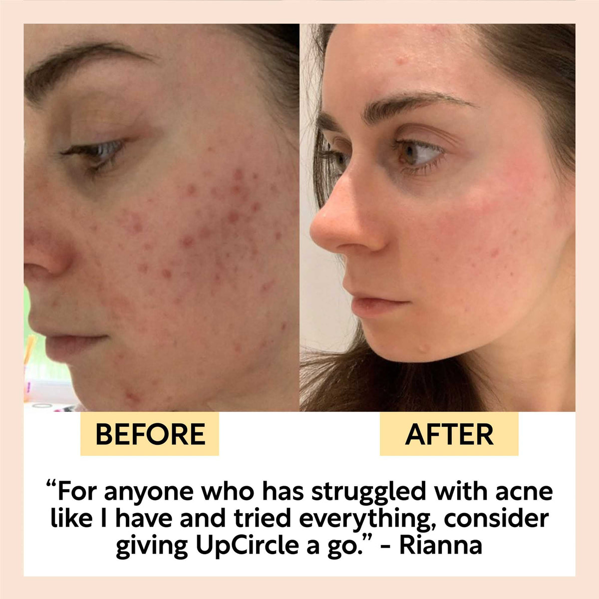 UpCircle Face Toner with Hyaluronic Acid