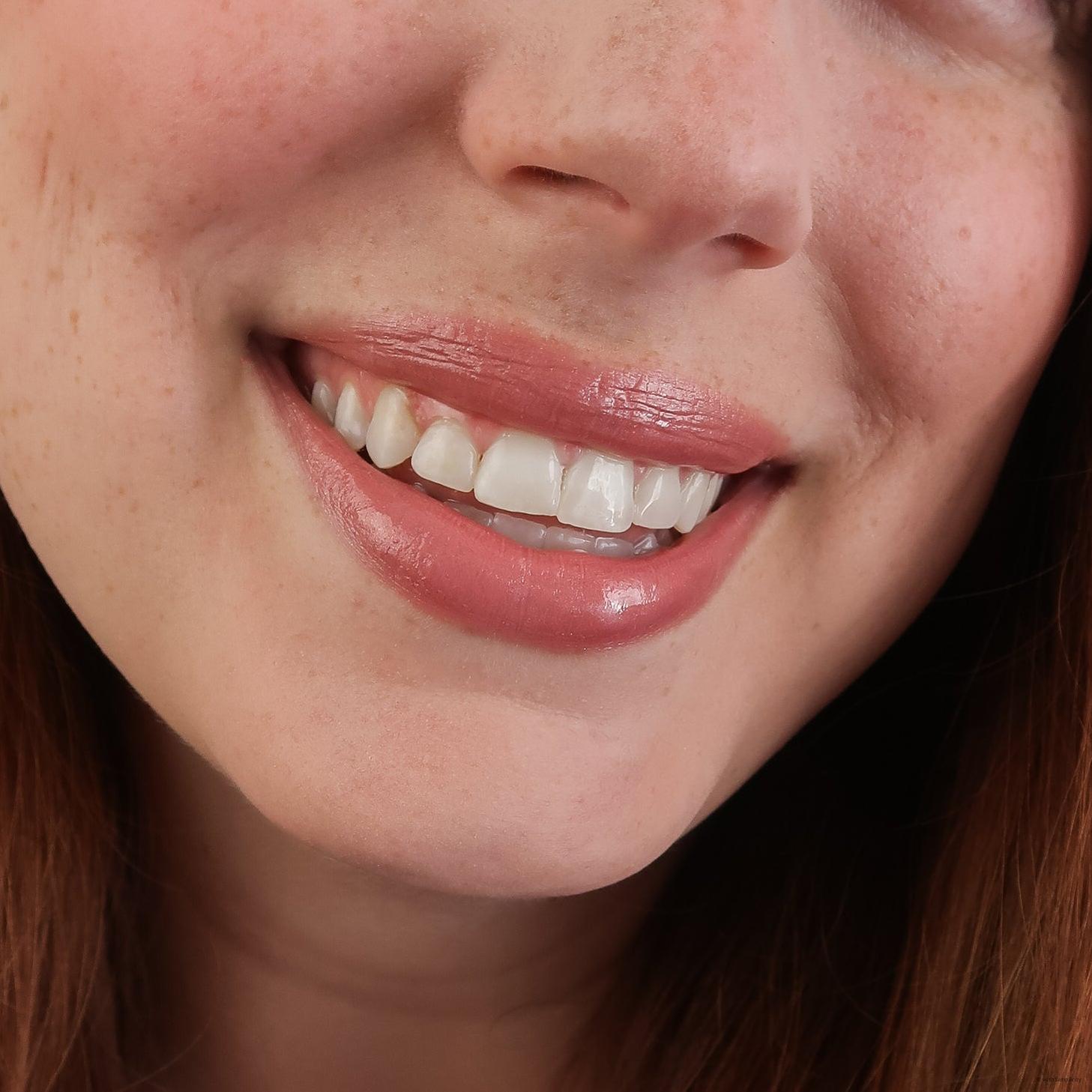 withSimplicity Lip Gloss