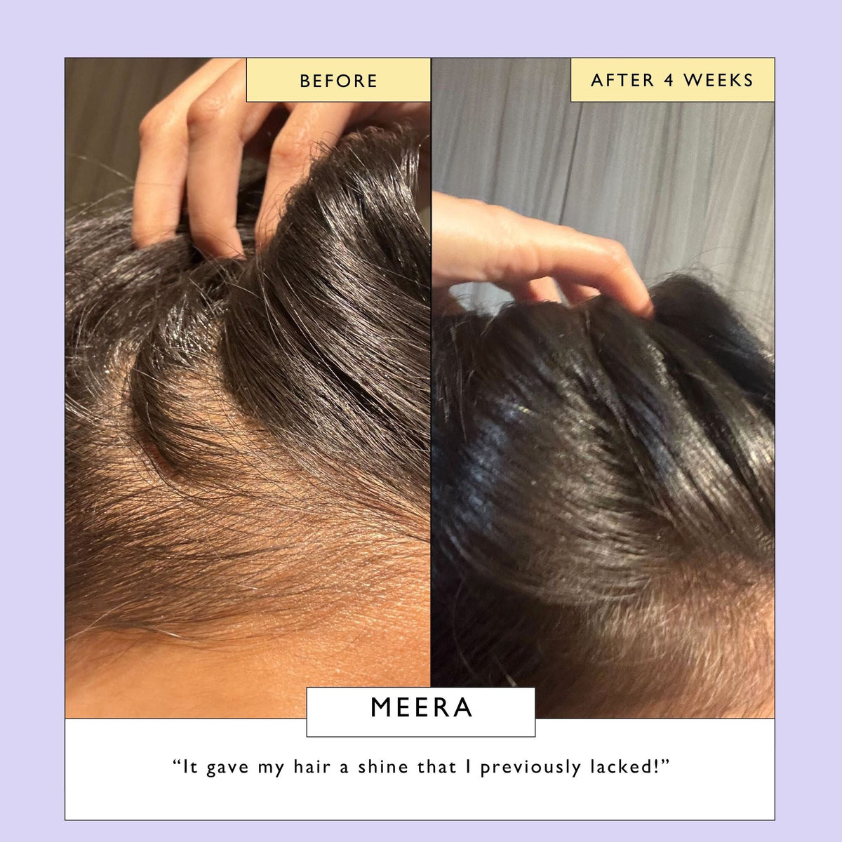 UpCircle Scalp + Hair Oil with Bacuri Butter + Castor Oil