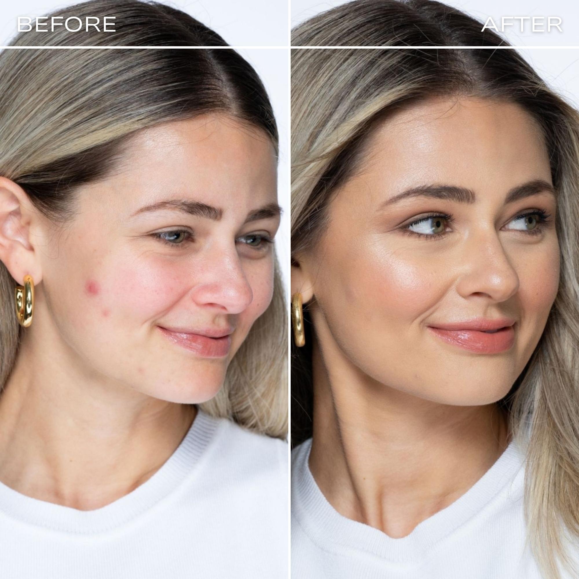 Fitglow Beauty Redness Rescue Corrective Palette