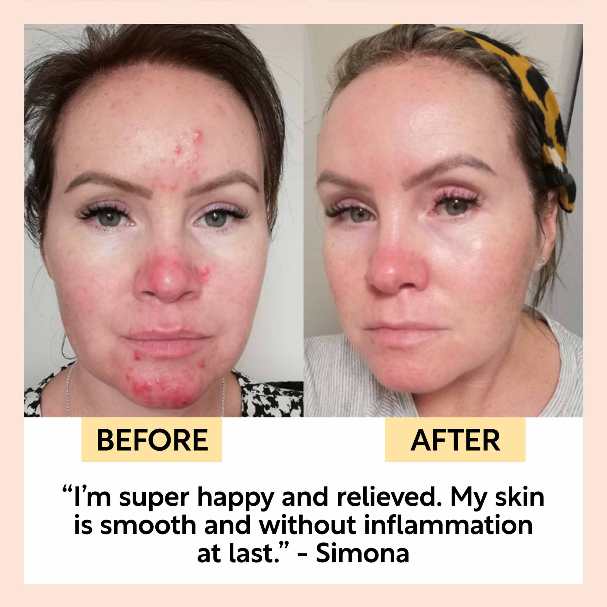 UpCircle Night Cream with Hyaluronic Acid + Niacinamide