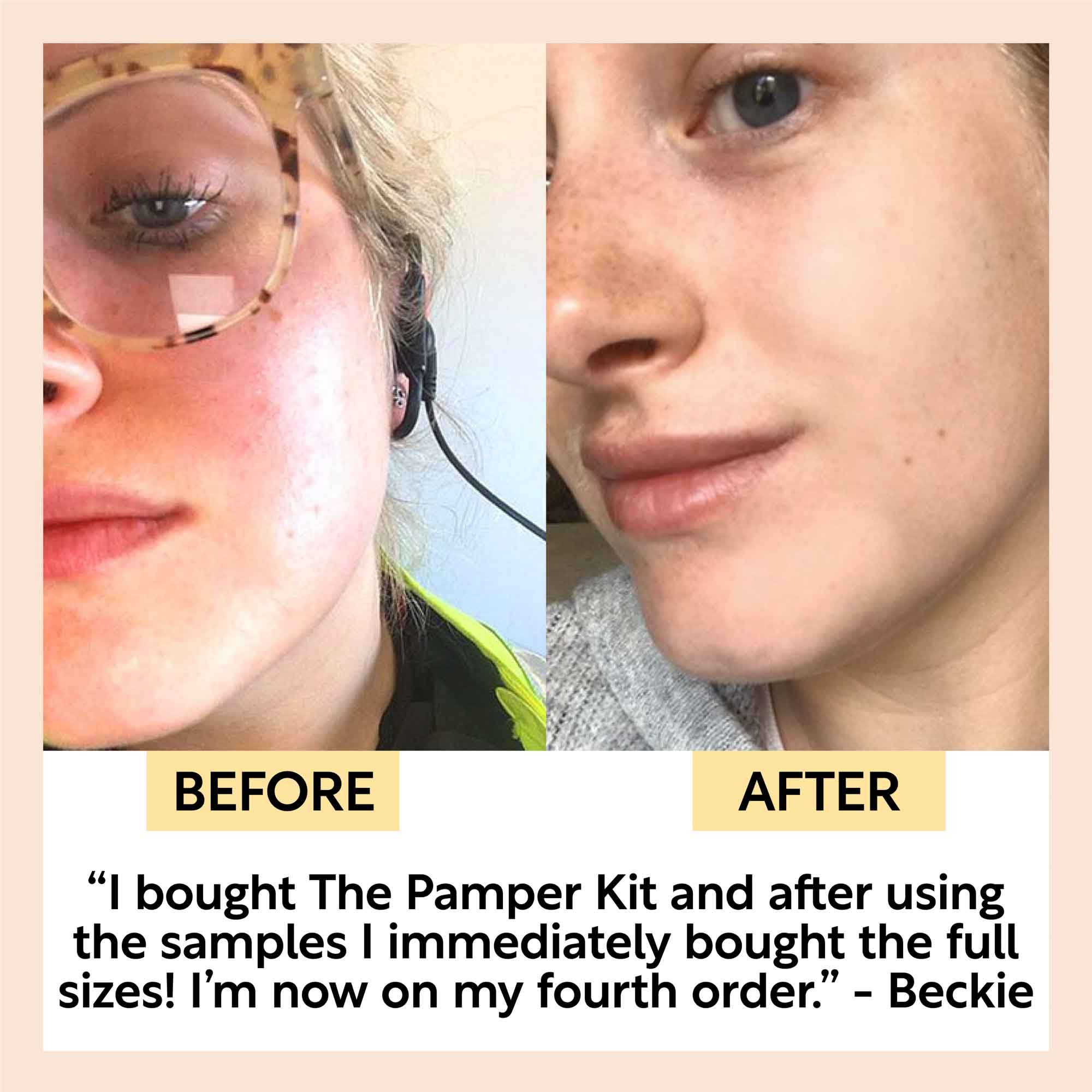 UpCircle The Pamper Kit - 17 Pieces