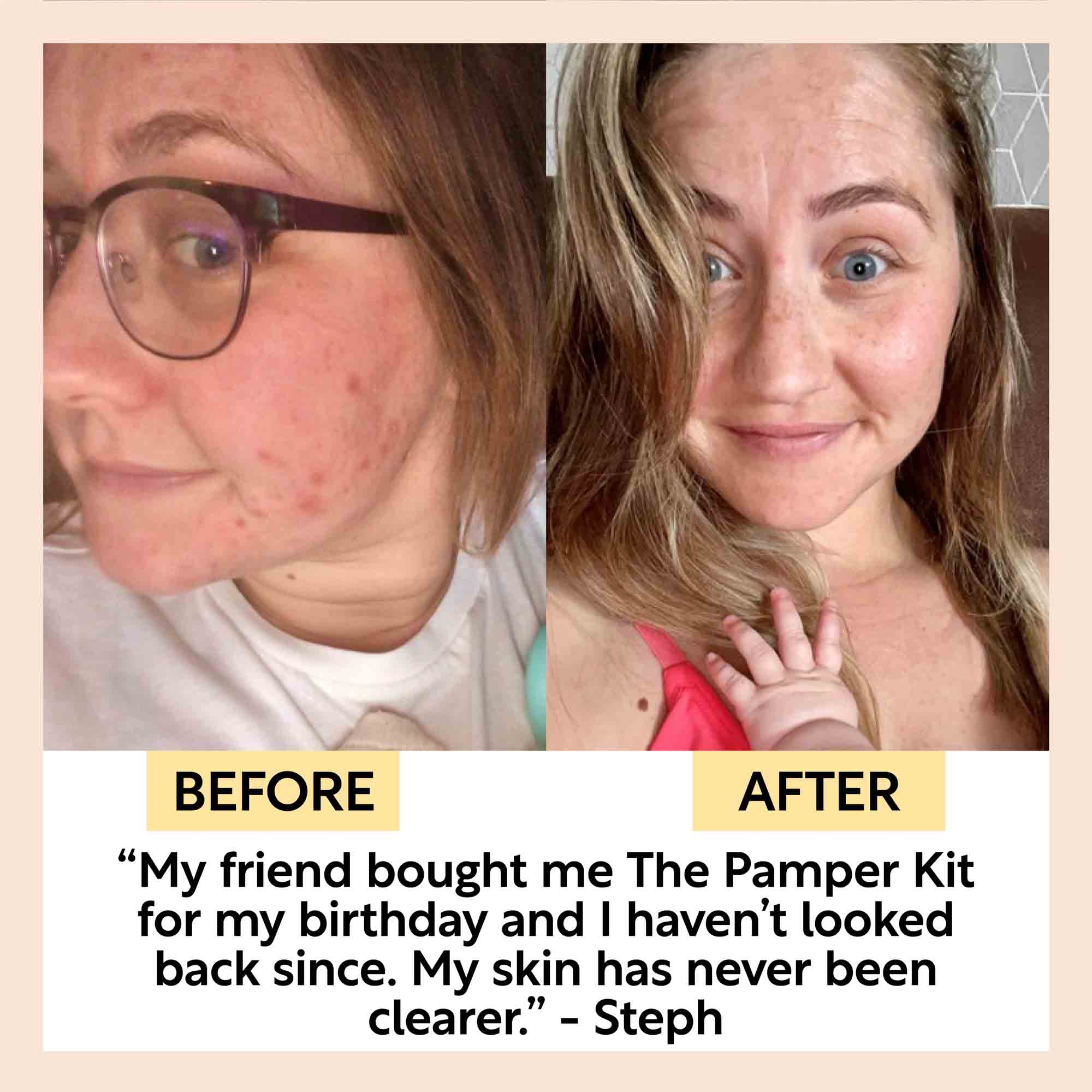 UpCircle The Pamper Kit - 17 Pieces