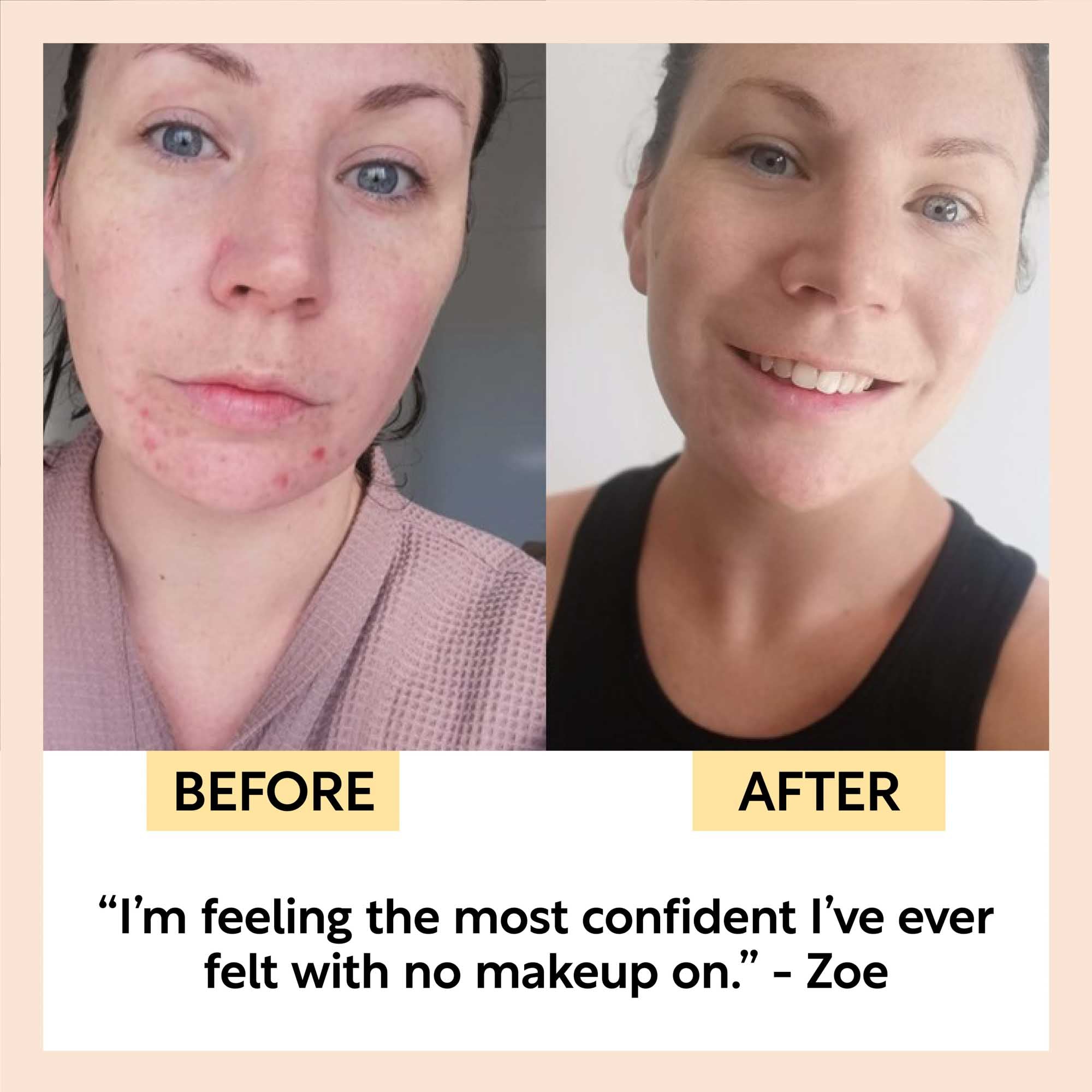 UpCircle Travel-Size Skincare Bundle