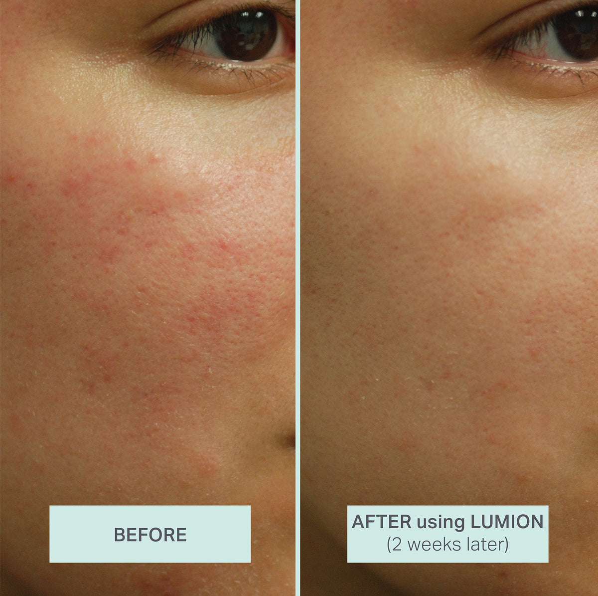 Lumion Miracle Mist