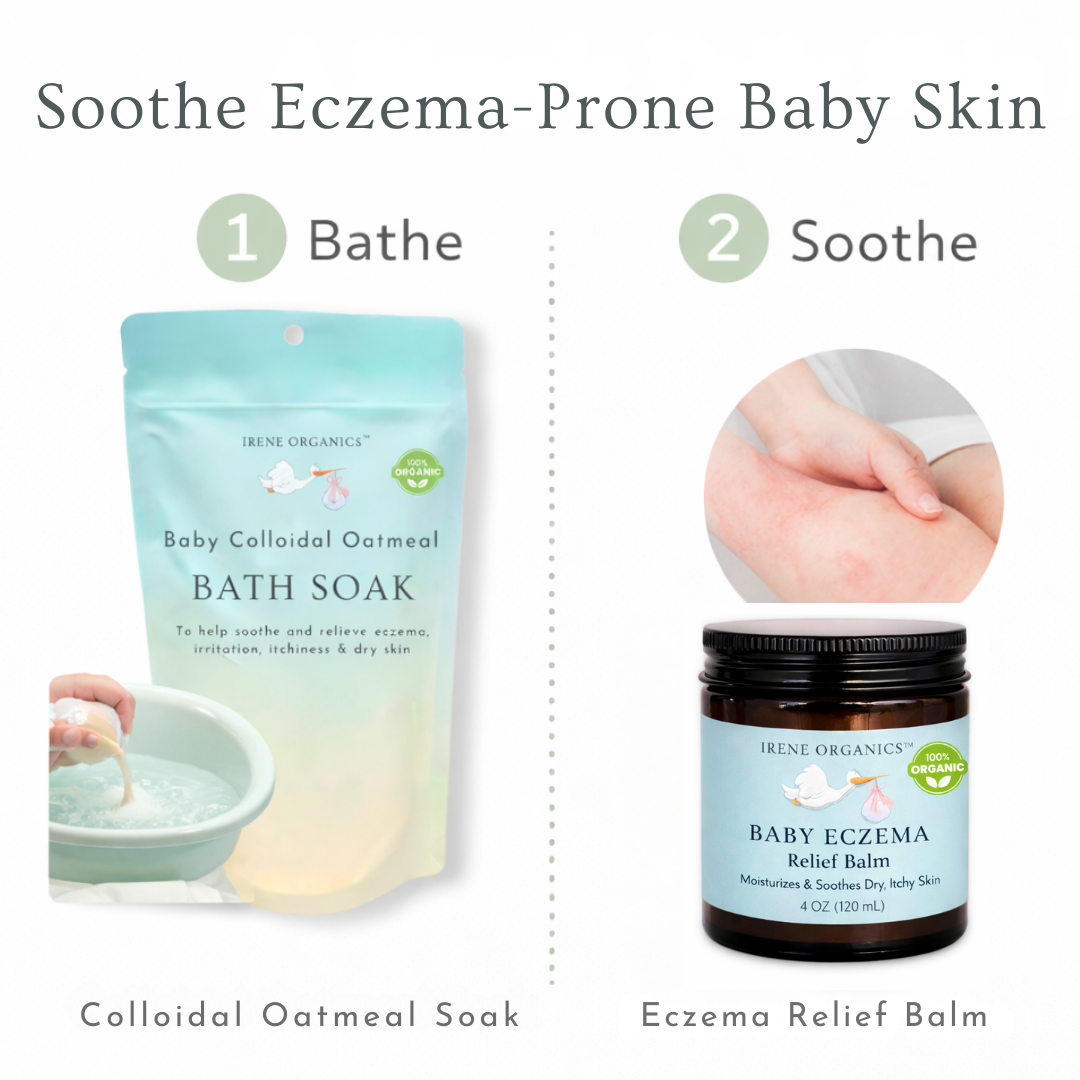 Irene Organics Baby Eczema Relief Bundle