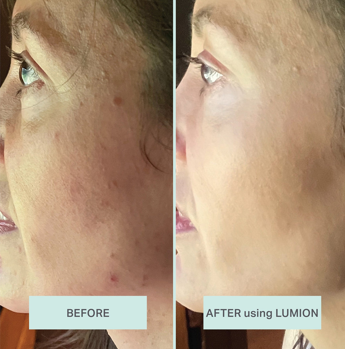 Lumion Miracle Mist