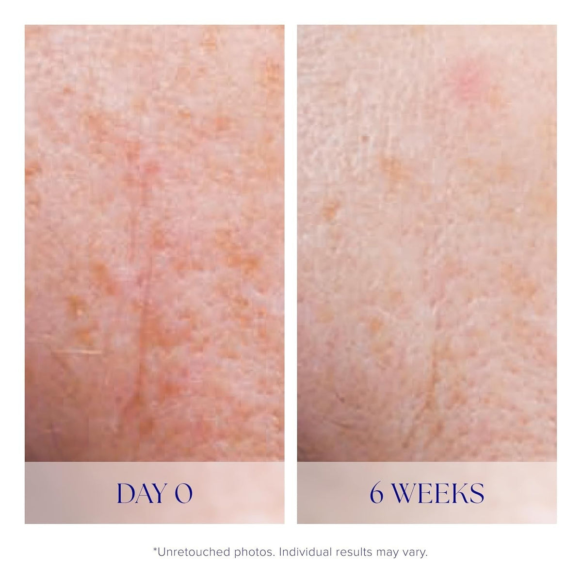 iS Clinical Active Serum 15 mL — image 4