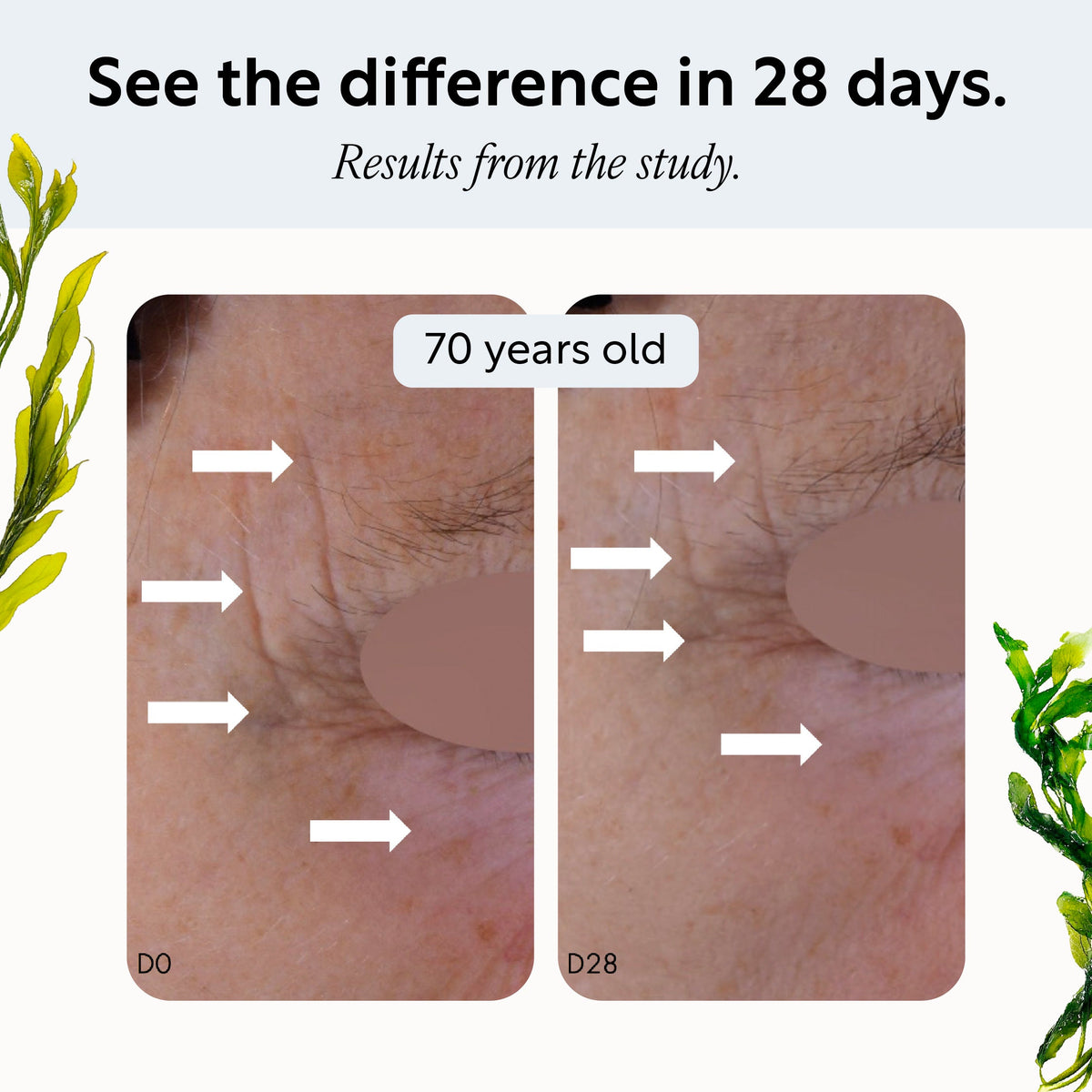 UpCircle Overnight Eye Treatment with Retinol Exosomes