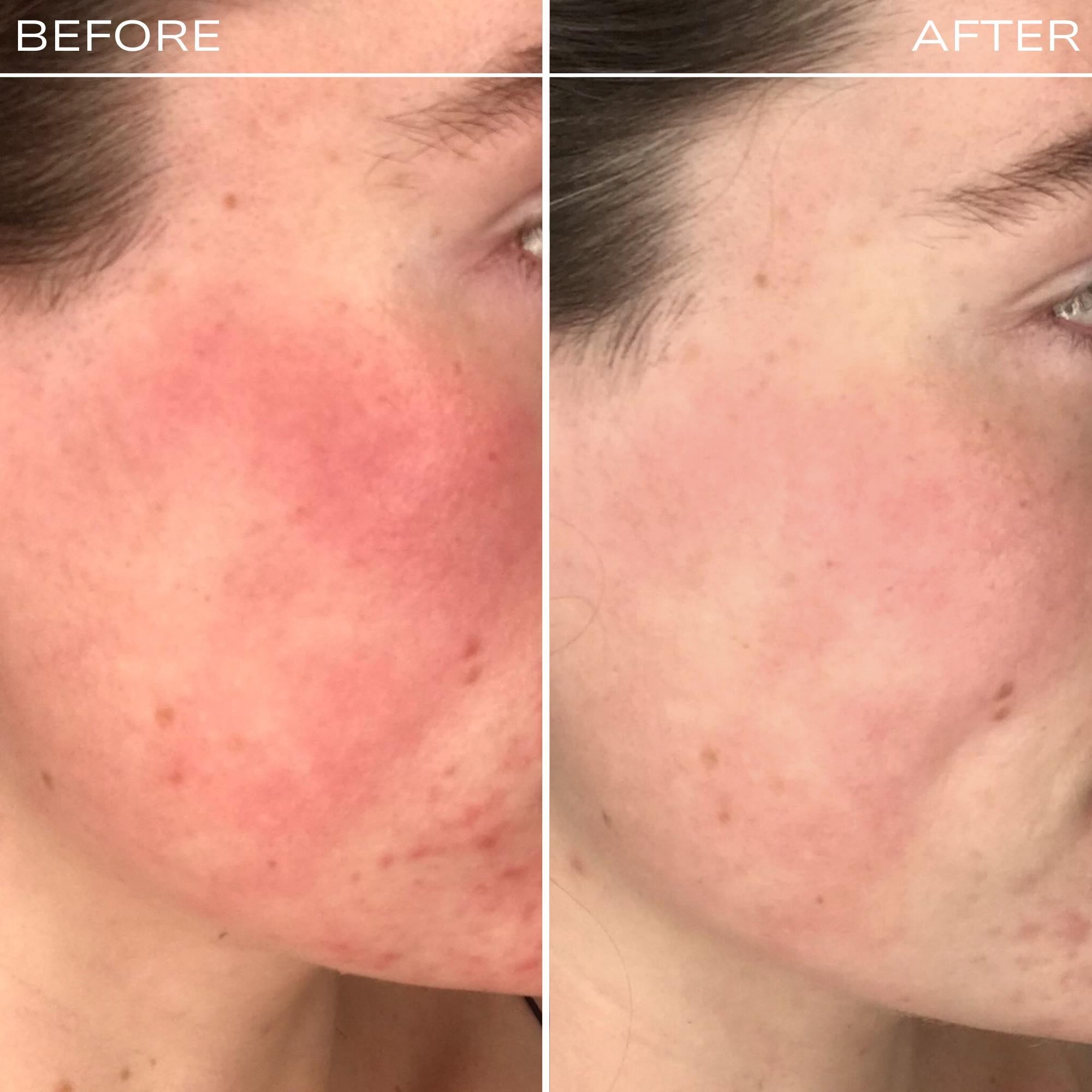 Fitglow Beauty Redness Rescue Cream (RRC)