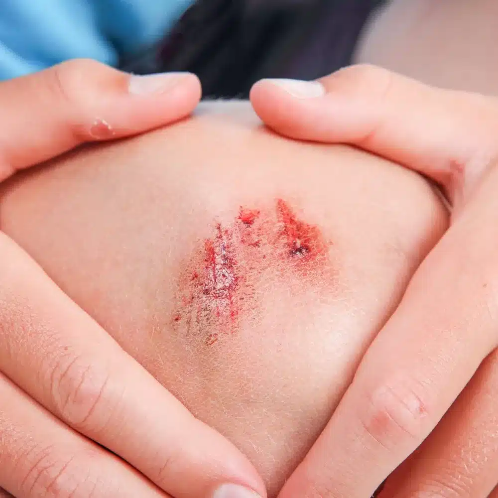 What’s Wrong With Neosporin?
